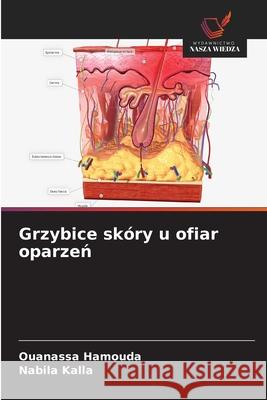 Grzybice skóry u ofiar oparzen Hamouda, Ouanassa, Kalla, Nabila 9786208944254