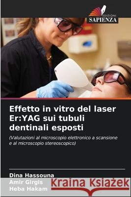 Effetto in vitro del laser Er:YAG sui tubuli dentinali esposti Hassouna, Dina, Girgis, Amir, Hakam, Heba 9786208945213
