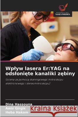 Wplyw lasera Er: YAG na odslonięte kanaliki zębiny Dina Hassouna Amir Girgis Heba Hakam 9786208945220