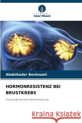 HORMONRESISTENZ BEI BRUSTKREBS Bentouati, Abdelkader 9786208952433 Verlag Unser Wissen