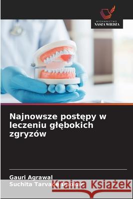 Najnowsze postepy w leczeniu glebokich zgryzów Agrawal, Gauri, Tarvade Daokar, Suchita 9786208952792