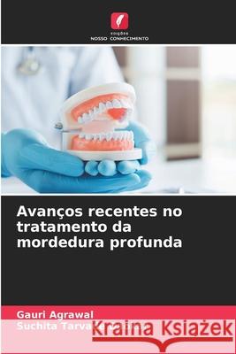 Avanços recentes no tratamento da mordedura profunda Agrawal, Gauri, Tarvade Daokar, Suchita 9786208952808