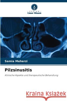 Pilzsinusitis Meherzi, Samia 9786208954444