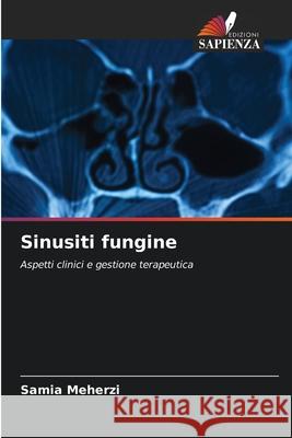 Sinusiti fungine Meherzi, Samia 9786208954475
