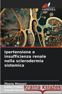 Ipertensione e insufficienza renale nella sclerodermia sistemica Mnoussi, Mouna, Frikha, Faten, Marzouk, Sameh 9786208955212 Edizioni Sapienza