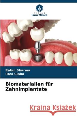 Biomaterialien für Zahnimplantate sharma, Rahul, Sinha, Ravi 9786208963019