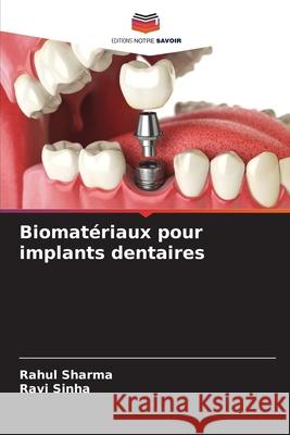 Biomatériaux pour implants dentaires sharma, Rahul, Sinha, Ravi 9786208963026