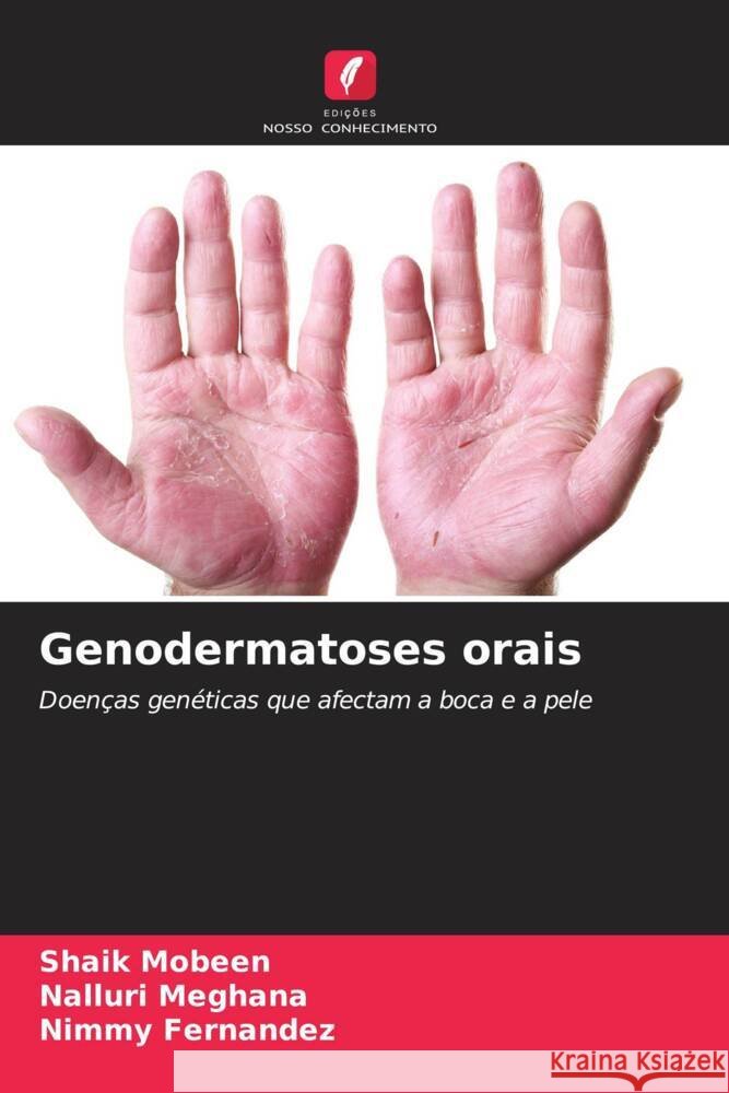 Genodermatoses orais Mobeen, Shaik, Meghana, Nalluri, Fernandez, Nimmy 9786208967642