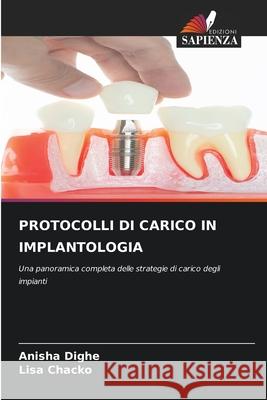 Protocolli Di Carico in Implantologia Anisha Dighe Lisa Chacko 9786208974695