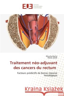 Traitement néo-adjuvant des cancers du rectum Bacha, Dhouha, Jedidi, Malek 9786208979065 Éditions universitaires européennes