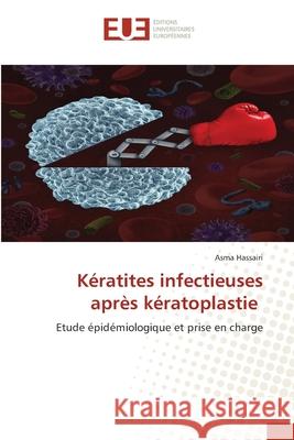 Kératites infectieuses après kératoplastie Hassairi, Asma 9786208980177