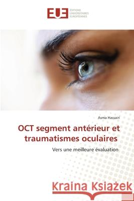 OCT segment antérieur et traumatismes oculaires Hassairi, Asma 9786208980184