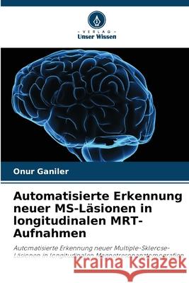 Automatisierte Erkennung neuer MS-Läsionen in longitudinalen MRT-Aufnahmen Ganiler, Onur 9786208982669 Verlag Unser Wissen