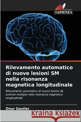 Rilevamento automatico di nuove lesioni SM nella risonanza magnetica longitudinale Ganiler, Onur 9786208982690 Edizioni Sapienza