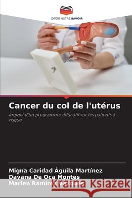 Cancer du col de l'utérus Águila Martínez, Migna Caridad, De Oca Montes, Dayana, Ramírez Vázques, Marlen 9786208983574