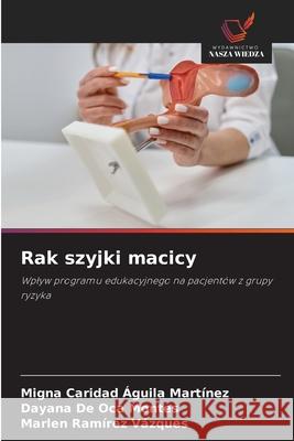 Rak szyjki macicy Águila Martínez, Migna Caridad, De Oca Montes, Dayana, Ramírez Vázques, Marlen 9786208983598