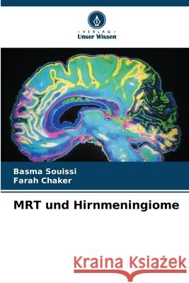 MRT und Hirnmeningiome Souissi, Basma, Chaker, Farah 9786208986926 Verlag Unser Wissen