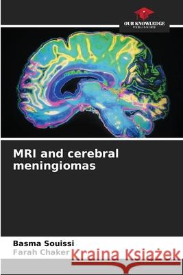 MRI and cerebral meningiomas Souissi, Basma, Chaker, Farah 9786208986933 Our Knowledge Publishing