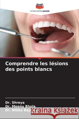 Comprendre les lésions des points blancs ,, Dr. Shreya, Bhola ,, Dr. Meenu, Bajaj, Dr. Nitika 9786209012969