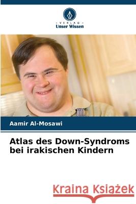 Atlas des Down-Syndroms bei irakischen Kindern Al-Mosawi, Aamir 9786209022135 Verlag Unser Wissen
