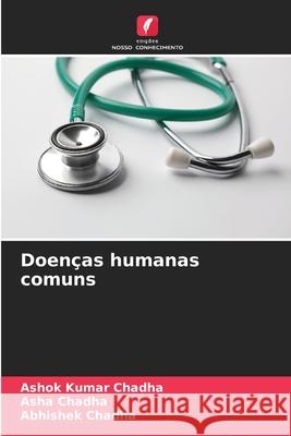 Doen?as humanas comuns Ashok Kumar Chadha Asha Chadha Abhishek Chadha 9786209022234