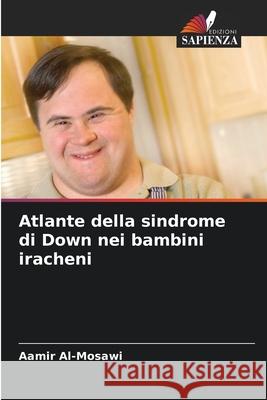 Atlante della sindrome di Down nei bambini iracheni Al-Mosawi, Aamir 9786209029813
