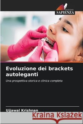 Evoluzione dei brackets autoleganti Krishnan, Ujjawal 9786209034510