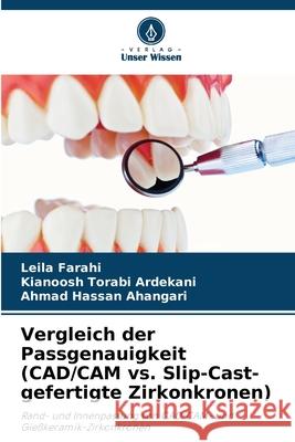 Vergleich der Passgenauigkeit (CAD/CAM vs. Slip-Cast-gefertigte Zirkonkronen) Farahi, Leila, Torabi Ardekani, Kianoosh, Hassan Ahangari, Ahmad 9786209038471