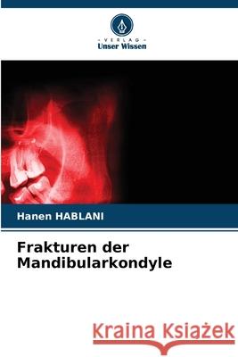 Frakturen der Mandibularkondyle HABLANI, Hanen 9786209038938