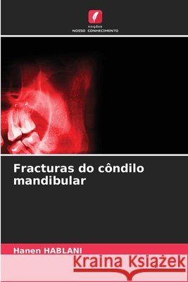 Fracturas do côndilo mandibular HABLANI, Hanen 9786209044052