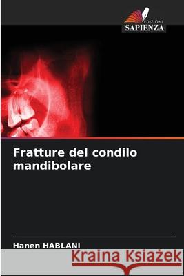 Fratture del condilo mandibolare HABLANI, Hanen 9786209049170 Edizioni Sapienza