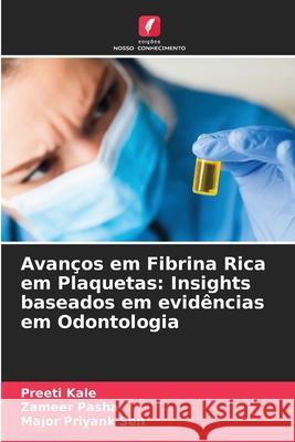 Avanços em Fibrina Rica em Plaquetas: Insights baseados em evidências em Odontologia Kale, Preeti, Pasha, Zameer, Sen, Major Priyank 9786209052637
