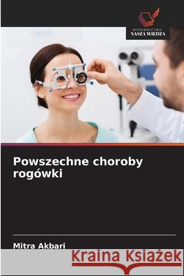 Powszechne choroby rogówki Akbari, Mitra 9786209054303