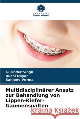 Multidisziplinärer Ansatz zur Behandlung von Lippen-Kiefer-Gaumenspalten Singh, Gurinder, Nayar, Ruchi, Verma, Sanjeev 9786209054723