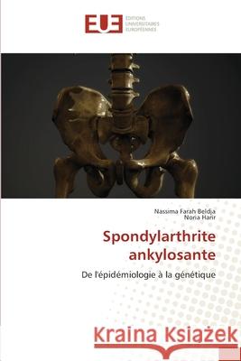 Spondylarthrite ankylosante Beldja, Nassima Farah, Harir, Noria 9786209059308
