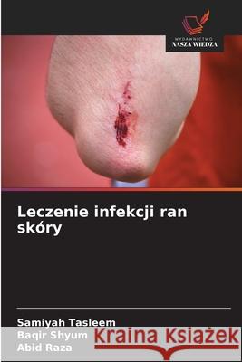 Leczenie infekcji ran skóry Tasleem, Samiyah, Shyum, Baqir, Raza, Abid 9786209060144