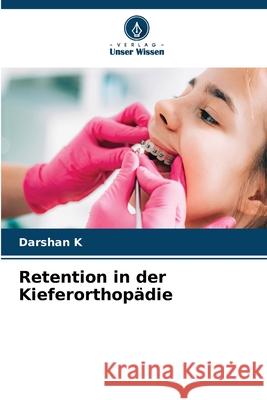 Retention in der Kieferorthopädie K, Darshan 9786209060700