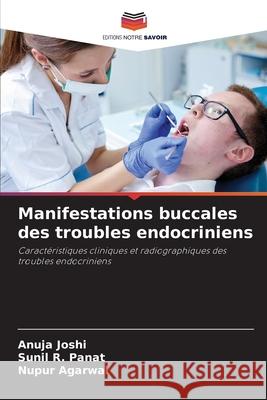 Manifestations buccales des troubles endocriniens Joshi, Anuja, Panat, Sunil R., Agarwal, Nupur 9786209063343