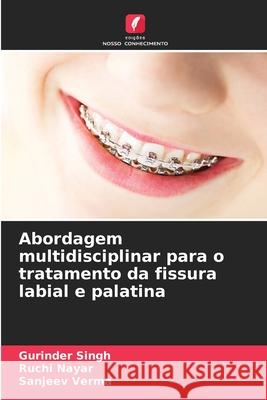 Abordagem multidisciplinar para o tratamento da fissura labial e palatina Singh, Gurinder, Nayar, Ruchi, Verma, Sanjeev 9786209064968