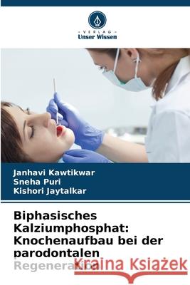 Biphasisches Kalziumphosphat: Knochenaufbau bei der parodontalen Regeneration Janhavi Kawtikwar Sneha Puri Kishori Jaytalkar 9786209066269