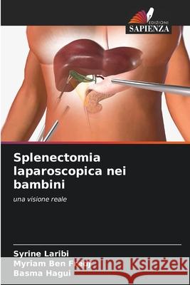 Splenectomia laparoscopica nei bambini Laribi, Syrine, Ben Fredj, Myriam, Hagui, Basma 9786209070044 Edizioni Sapienza