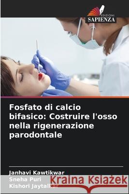 Fosfato di calcio bifasico: Costruire l'osso nella rigenerazione parodontale Janhavi Kawtikwar Sneha Puri Kishori Jaytalkar 9786209073946