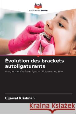 Évolution des brackets autoligaturants Krishnan, Ujjawal 9786209078026