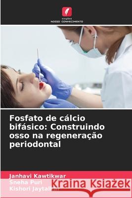 Fosfato de c?lcio bif?sico: Construindo osso na regenera??o periodontal Janhavi Kawtikwar Sneha Puri Kishori Jaytalkar 9786209079061