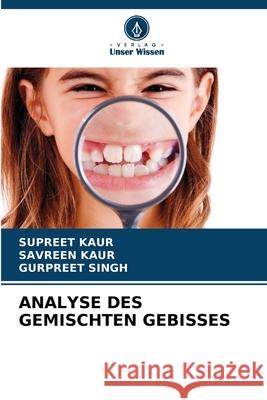 ANALYSE DES GEMISCHTEN GEBISSES Kaur, Supreet, Kaur, Savreen, Singh, Gurpreet 9786209080159
