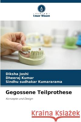 Gegossene Teilprothese Joshi, Diksha, Kumar, Dheeraj, Kumararama, Sindhu Sudhakar 9786209088506