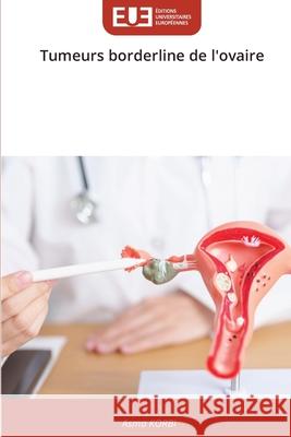 Tumeurs borderline de l'ovaire KORBI, ASMA 9786209089602 Éditions universitaires européennes