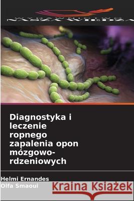Diagnostyka i leczenie ropnego zapalenia opon mózgowo-rdzeniowych Ernandes, Helmi, Smaoui, Olfa 9786209089633
