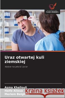 Uraz otwartej kuli ziemskiej khallouli, Asma, Alioua, Haifa, Belghith, Meriem 9786209095115