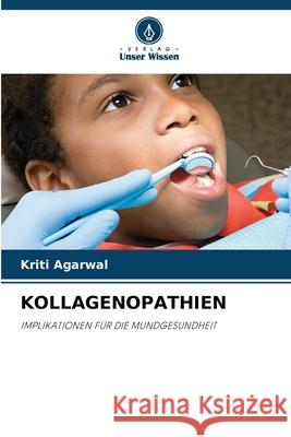 KOLLAGENOPATHIEN Agarwal, Kriti 9786209096433